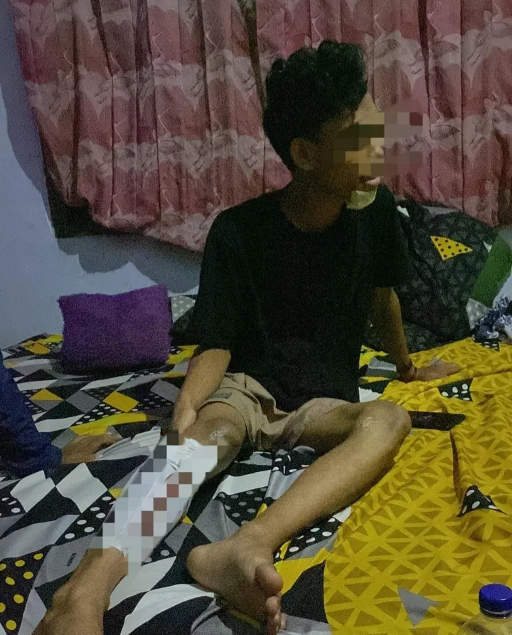 Pengeroyokan Suporter Jakmania di Depan Stadion Maulana Yusuf Serang, Ilham Jadi Korban Brutal Usai Nonton Bareng