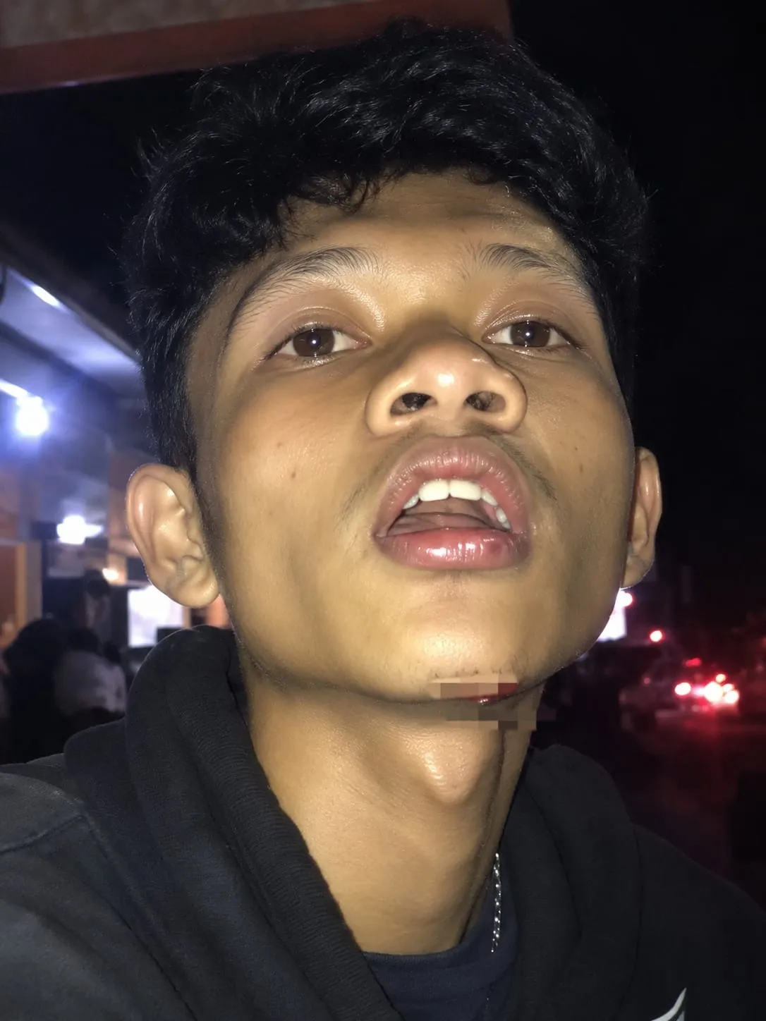Brutal Tanpa Provokasi! Geng Motor Brantas Kepung dan Aniaya Seorang Pemuda di Jalan Ibrahim Aji