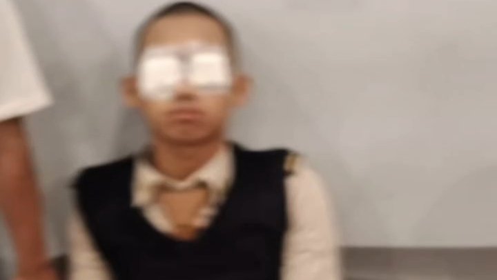 Tiga Pelajar Siram Air Keras ke Siswa SMK Pelayaran di Cempaka Putih Jakarta Pusat, Satu Korban Luka Parah di Mata