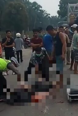 Tragis, Kecelakaan di Jalan Kap Anyar Bogor Sebabkan Luka Parah